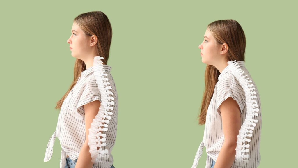 The Power of Posture: Unveiling the Secrets to a Healthy Spine